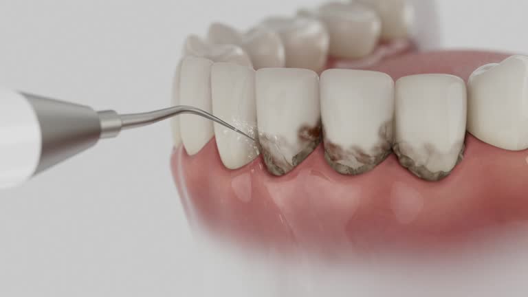 Reliable Dental Implants contractor in Brodhead, KY by Smile Center Dentistry
